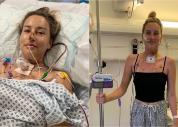 Mulher tem língua reconstruída com músculos da perna após câncer de boca raro; veja vídeo