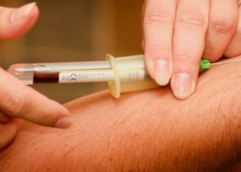 Cientistas brasileiros avançam em diagnóstico de Alzheimer a partir de exames de sangue