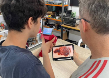Projeto de escola no RS cria tecnologia para identificar sinais de câncer de pele com IA