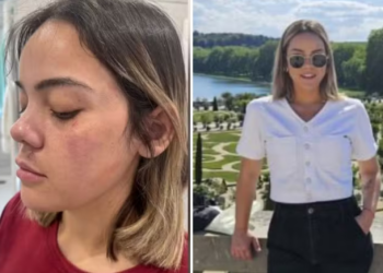 Brasileira vítima de tentativa de estupro em Paris é ouvida em tribunal: 'Espero que a justiça seja feita'