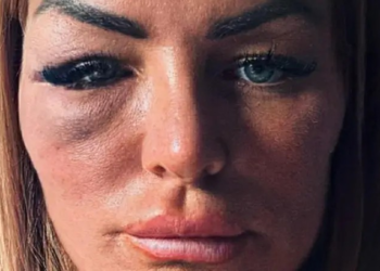 'Não aceitei sair com um lutador de MMA — e ele me deu um soco'