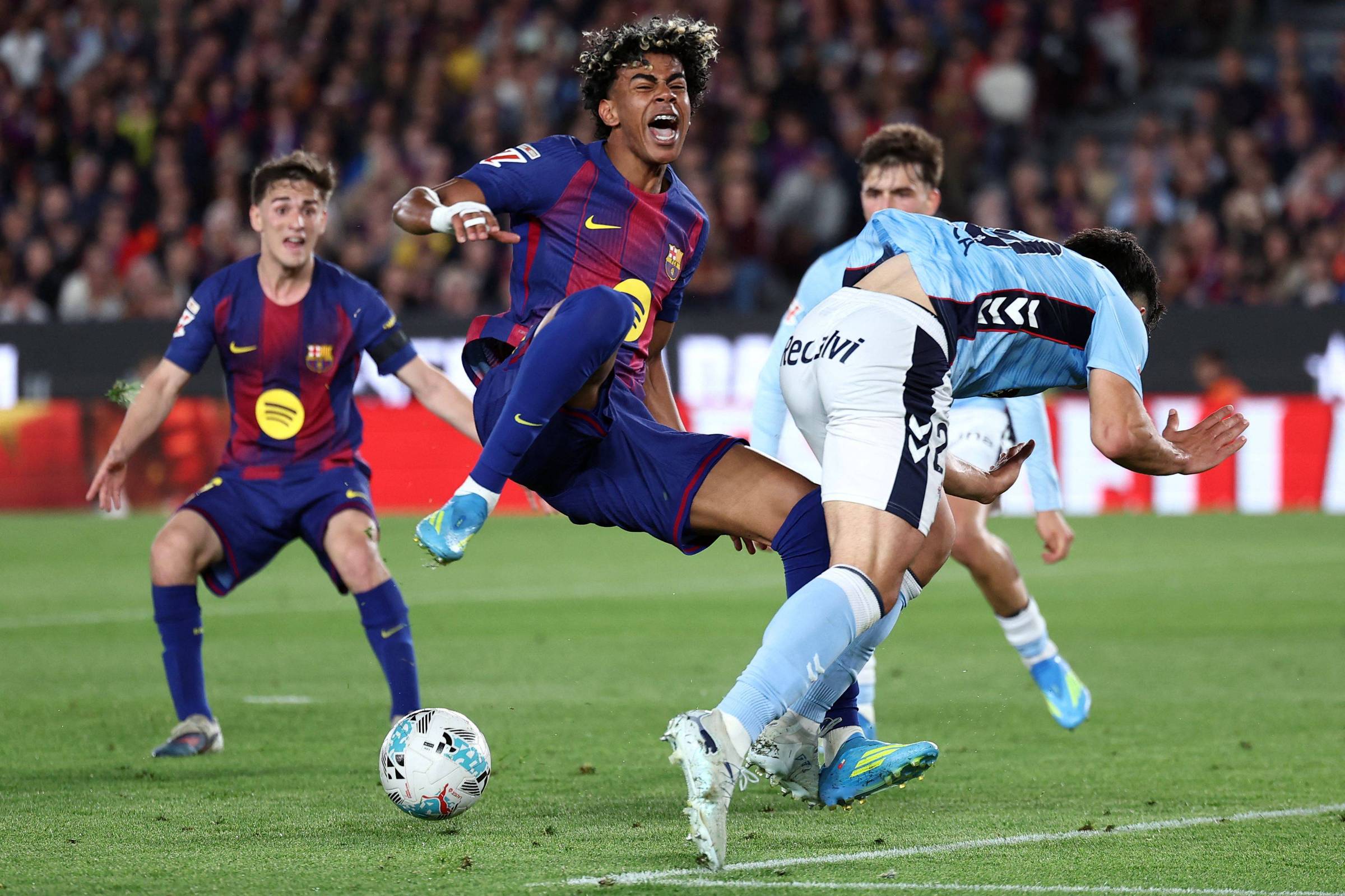 Bíceps femoral, um vilão às portas da Copa do Mundo