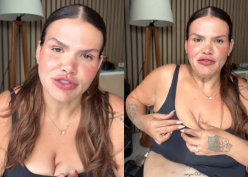 Thais Carla faz desasbafo e mostra flacidez após perder 100 kg