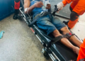 Homem tem crânio afundado após sofrer “salve”, foge e pede socorro em base da Guarda Municipal