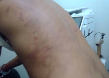 Ministério Público investiga denúncias de tortura por detentos em presídios do agreste de Pernambuco